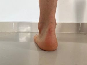 Lifebalance Foot Care | Our Services
