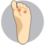 Lifebalance Foot Care | Foot Conditions