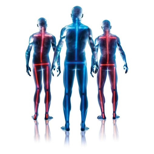 Lifebalance Foot Care | Common Foot Types and Their Biomechanical Impacts